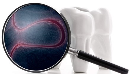 Działalność bakterii przyczyną paradontozy